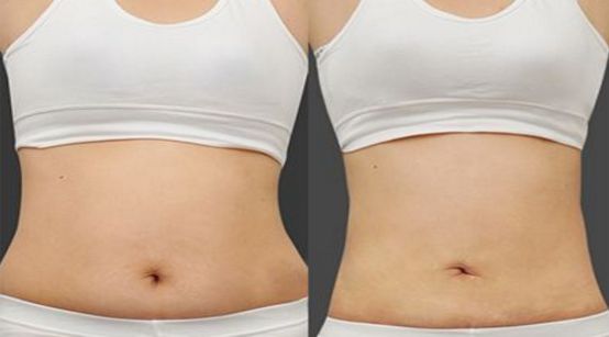 搶先掌握北京市雙眼皮醫(yī)生榜單名單，詳細(xì)了解醫(yī)生資料