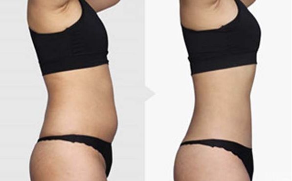 上海最受歡迎的除皺整形醫(yī)院排名2023！這些頂級(jí)醫(yī)院讓你輕松恢復(fù)青春！