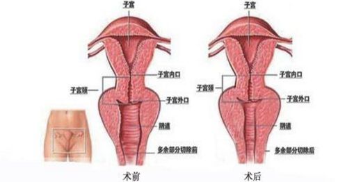上海九院哪里能夠得到專業(yè)的隆鼻手術(shù)？排行榜最新推薦五位頂尖隆鼻專家