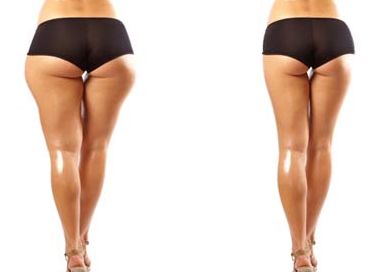 國(guó)內(nèi)去疤痕醫(yī)院匯總~領(lǐng)先技術(shù)助力去除疤痕與胎記