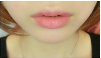 長春治療皮膚斑點選擇哪個醫(yī)院靠譜？當?shù)刂t(yī)院推薦目錄一覽