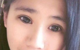 羅飛彪醫(yī)生開展的鼻子整形手術，售價一覽表，各種風格任你挑選！