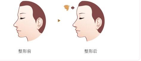 綿陽碧蓮盛植發(fā)醫(yī)院的效果如何？如何查詢地址及醫(yī)生信息？