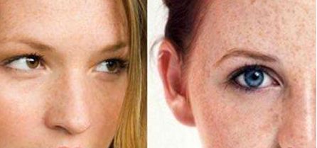 北京大學(xué)深圳醫(yī)院鼻子整形科2023近期成果展示