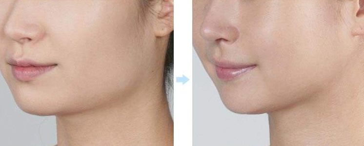 成都整形醫(yī)院揭曉：這五家醫(yī)院獲得排名前列！