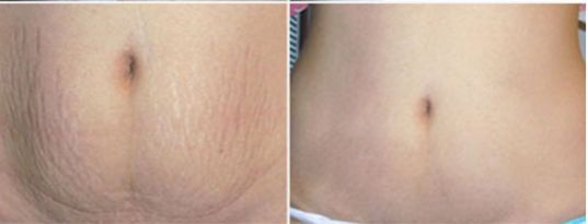 多位知名醫(yī)生修復(fù)雙眼皮技術(shù)對(duì)比，王太玲和盧建建誰(shuí)更出眾？立體醫(yī)學(xué)美容室推薦名醫(yī)修復(fù)雙眼皮解析及價(jià)格大