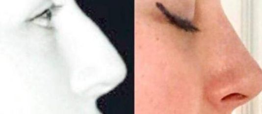 杭州整容醫(yī)生：陳小平、曾海峰長期位居榜首