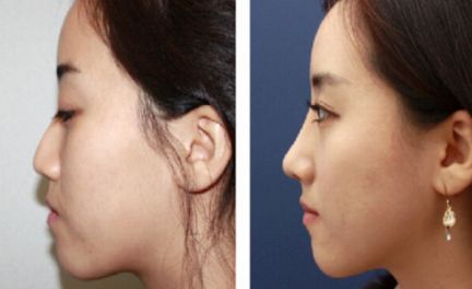 廈門整形醫(yī)院綜合評比，首屈一指的醫(yī)療機構(gòu)引領行業(yè)潮流