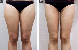 江蘇省人民醫(yī)院皮膚科醫(yī)生榮列榜單｜醫(yī)生個人背景資料詳解