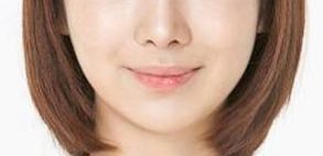 胡小芮寧夏醫(yī)科大學附屬醫(yī)院：醫(yī)療機構概況及雙眼皮修復案例分享