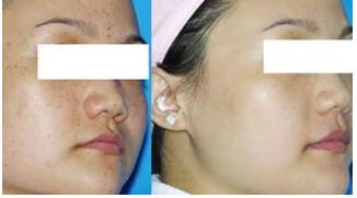 成都圣丹福賀忠波隆胸術(shù)實(shí)踐回顧，驚人成效曝光！