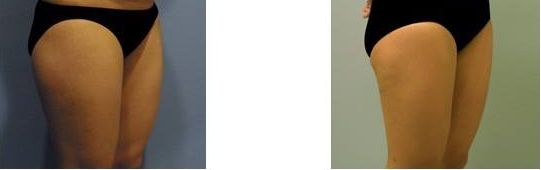 沈陽(yáng)雙眼皮整形醫(yī)生哪位技術(shù)出眾？受歡迎的三位醫(yī)師推薦2023