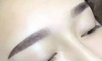 杜園園2023年雙眼皮修復(fù)案例揭秘，浦東區(qū)獨家經(jīng)驗分享