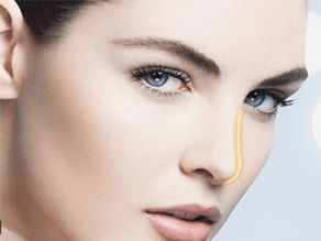 煙臺(tái)曹品根醫(yī)生的雙眼皮修復(fù)經(jīng)驗(yàn)揭秘，90天修復(fù)案例全記錄