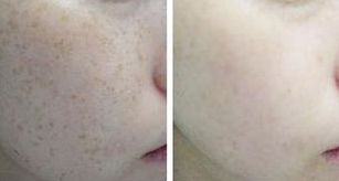 2023上海整容醫(yī)生榜單揭曉：韋敏、柴崗、林曉曦等榮登榜首