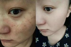 全國(guó)治療拉皮手術(shù)頗具實(shí)力的整形醫(yī)院公布：排名之選非他莫屬！