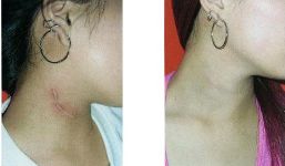 全國各大醫(yī)院推薦！拉皮手術(shù)高水平醫(yī)院盤點