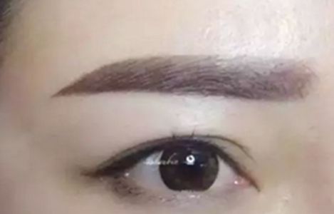 南昌美伊爾醫(yī)院的劉立軍醫(yī)生手術(shù)實(shí)力如何？擅長哪些手術(shù)？附真實(shí)案例為參考