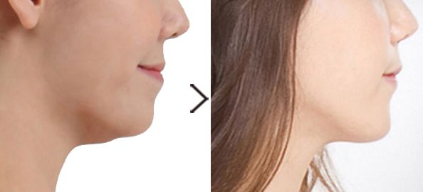 整形美容院選擇指南：華美、珍潤(rùn)、藍(lán)山等品牌綜合比較，價(jià)格一覽表！