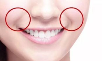 北京八大處整容院滕利醫(yī)生擅長(zhǎng)哪些項(xiàng)目？磨骨案例被公開(kāi)揭秘