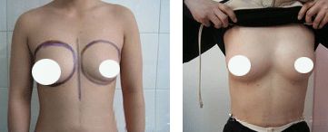 武漢優(yōu)秀鼻部專家排行榜公布，前五位備受矚目