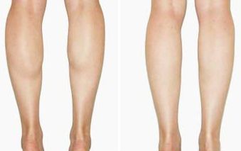 探尋南山整形醫(yī)院實力！醫(yī)生陣容揭秘+雙眼皮整形案例賞析