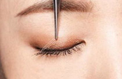 鄭州賈亮眼部整形技術介紹，修復雙眼皮效果如何？成功案例披露