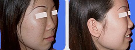 上海九院某醫(yī)生空前火爆！有幸親歷他的高超吸脂術(shù)！價(jià)格一覽來啦！