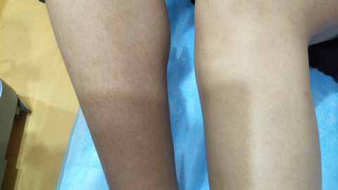 湘西自治州人民醫(yī)院燒傷美容整形科是否能滿足療效和口碑的雙重期望？有哪些備受推崇的醫(yī)生值得推薦？