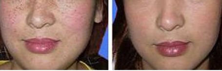 龍崗中心醫(yī)院整形科的雙眼皮修復(fù)醫(yī)生怎么樣？