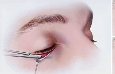 鼻部整形專家推薦：北京伊萊美哪位醫(yī)生技術(shù)一流？王冀耕、李旭東等好評如潮！