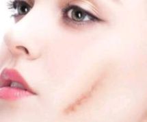 北京雙眼皮技術(shù)出色的醫(yī)院榜單，手術(shù)滿意度高贊醫(yī)院共享