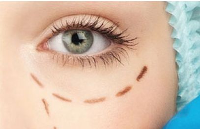 2023年首都北京近視手術(shù)醫(yī)生排行曝光！全面評估：口碑價(jià)位詳解，助你找到最佳矯正方案！