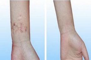 廣州地區(qū)口碑良好的植發(fā)醫(yī)院有哪些？就醫(yī)者推崇的醫(yī)院排名揭秘