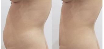 全國(guó)鼻子整形醫(yī)院排名揭曉，這幾家醫(yī)院上榜！