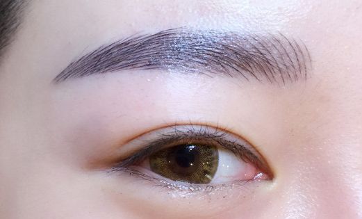 徐利剛：杭州藝星整形臨床實力派！鼻子整形解析，案例詳解！