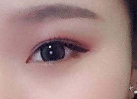 蔣小花醫(yī)生手術(shù)的實(shí)際操作方法和評(píng)價(jià)分享，多樣風(fēng)格消解揭秘！