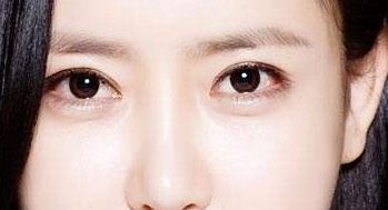 益陽(yáng)市中心醫(yī)院整形科去除眼袋獨(dú)創(chuàng)新方式2023案例解析