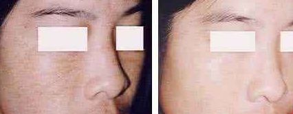 福州美貝爾醫(yī)療美容門診部：薛欣醫(yī)生用戶評(píng)價(jià)高？真實(shí)案例分享！