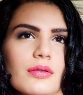 王太玲雙眼皮修復(fù)前后效果展示，讓您信心重拾！