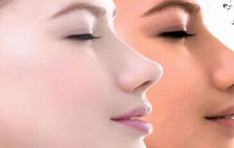 國內(nèi)十大隆鼻醫(yī)院官方認(rèn)證！精選口碑醫(yī)院，曙光、美萊等實力推薦！