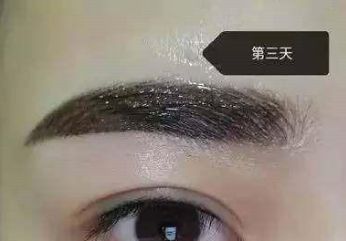 長(zhǎng)沙美萊隆胸醫(yī)生的評(píng)價(jià)如何？醫(yī)療背景與口碑信息一一梳理