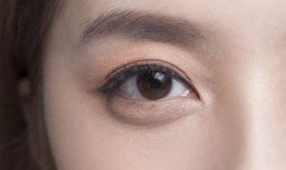 2023最新！精彩譚謙雙眼皮案例大揭秘，實(shí)景術(shù)后反饋引爆網(wǎng)絡(luò)