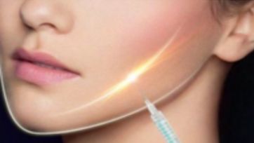 盧建建雙眼皮手術(shù)——醫(yī)生介紹與案例分享