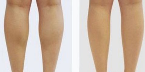 北京八大處楊欣好評傳遍朋友圈！揭秘90天顛覆性隆鼻之旅