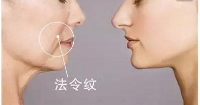 韋元強(qiáng)swan吸脂修復(fù)方法介紹，相關(guān)醫(yī)院推薦