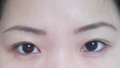 北京明會(huì)紅醫(yī)療美容診所價(jià)格表真實(shí)嗎？你會(huì)不會(huì)覺得有點(diǎn)匪夷所思？