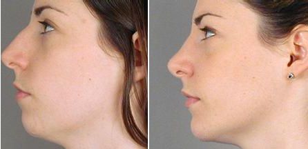 廣州熱瑪吉治療中心排行揭曉！醫(yī)院熱門榜單直擊