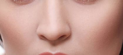 李湘源隆鼻案例，技術(shù)與反饋圖及價格表分享！