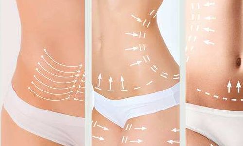 2023年武漢吸脂抽脂醫(yī)生（專家）技術(shù)分享：張軍、張繼強(qiáng)、劉洋等探討